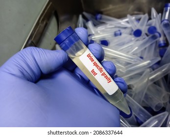 Urine Sample For Urine Specific Gravity Test, It Can Help Determine How Well Your Kidneys Are Diluting Your Urine.