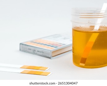 Urine sample in a sterile container, with test strips and a color chart isolated on white background