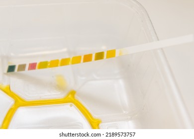  A Urine Sample With Test Strip Waiting For Evaluation