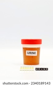 A urine sample for testing. Vertical, space for text.