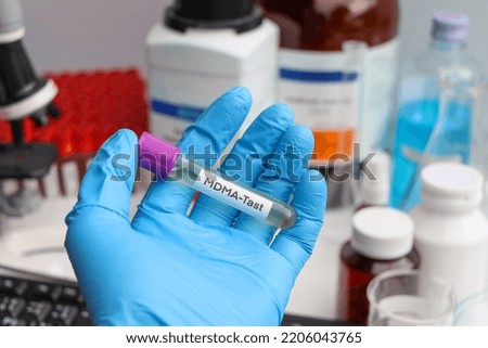Urine samples for testing MDMA in the laboratory, urine sample in test tube