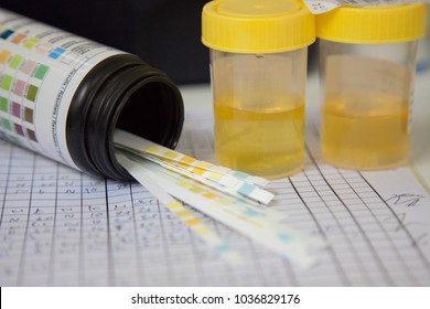 Urine Strip Test And Urine Cup 