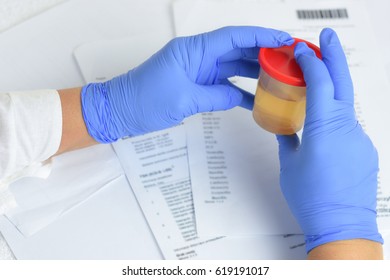 Urine Test.