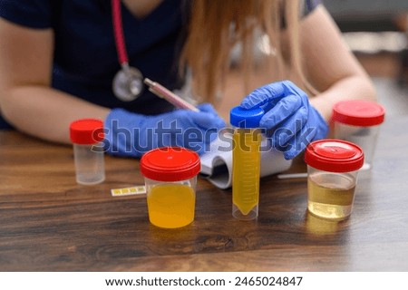 Urine test, describe samples in the laboratory