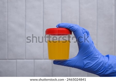 Urine test, hold the urine container with the sample collected for testing in your hand with a medical glove close up