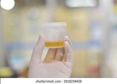 Urine Test Laboratory Equipment For Urinalysis Yellow Cap Tubes Set Empty Filled Frozen And Dipstick Icon Set Isolated Elements.