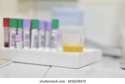 Urine Test Laboratory Equipment For Urinalysis Yellow Cap Tubes Set Empty Filled Frozen And Dipstick Icon Set Isolated Elements.