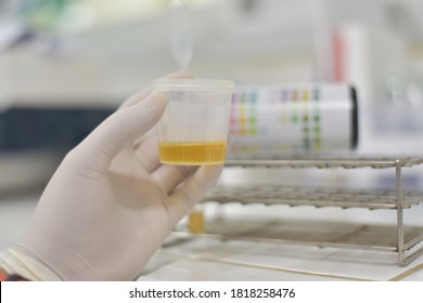 Urine Test Laboratory Equipment For Urinalysis Yellow Cap Tubes Set Empty Filled Frozen And Dipstick Icon Set Isolated Elements.