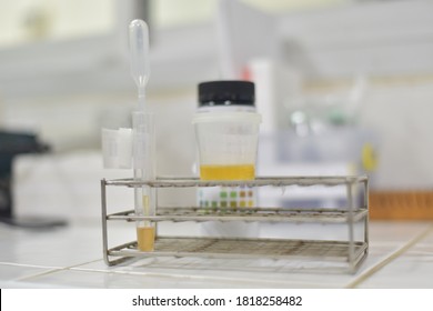 Urine Test Laboratory Equipment For Urinalysis Yellow Cap Tubes Set Empty Filled Frozen And Dipstick Icon Set Isolated Elements.