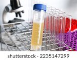 Urine test to look for abnormalities from Urine,  Urine sample to analyze in the laboratory, Urine in test tube