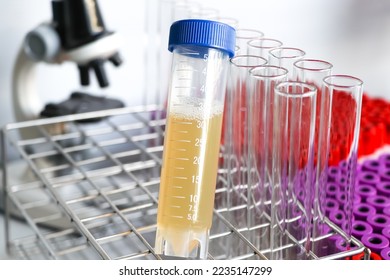 Urine test to look for abnormalities from Urine,  Urine sample to analyze in the laboratory, Urine in test tube