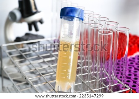 Urine test to look for abnormalities from Urine,  Urine sample to analyze in the laboratory, Urine in test tube