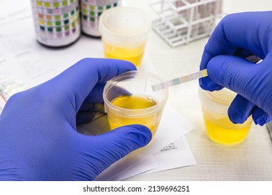 urine test, made with a vial of Urinalysis Reagent Strip used for ketosis control, laboratory examination.