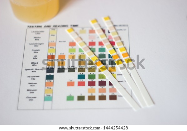 Urine Test Chart