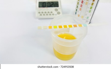 Urine Test Strip Or Dipstick Test Used To Determine Pathological Changes In A Patient Urine Sample. The Test Read Result In 60 To 120 Seconds After Immersed Strip In Urine Specimen. Selective Focus.