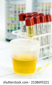 urine vial in laboratory, toxicology or routine examination