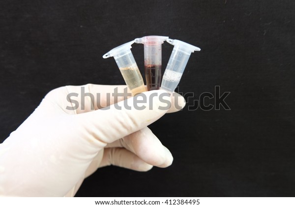 Urine,Blood,Saliva in\
tubes for laboratory\
testing.