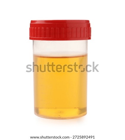 Urology. Container with urine sample for analysis isolated on white