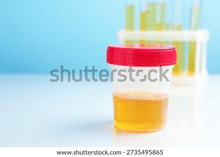 Urology. Container with urine sample for analysis and test tubes on white table against light blue background, closeup. Space for text