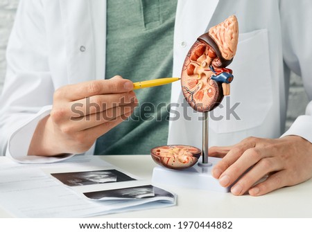 Urology and treatment of kidney disease. Doctor analyzing of patient kidney health using kidney ultrasound and anatomical model Stockfoto © 