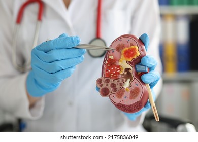 Urology and treatment of kidney diseases closeup - Shutterstock ID 2175836049