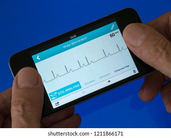 User Holding Portable Handheld ECG EKG Heart Monitor App Running On Mobile Phone With Trace Showing Sinus Heart Rhythm With Extra Ectopic Beat.