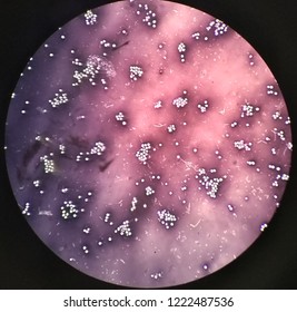 Using a 400x lens microscope, use aniline black, negatively stained bacteria.
