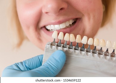 Using shade guide at mouth to check veneer of teeth