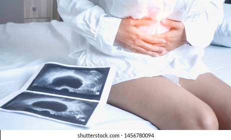 Uterus, Ovaries, Ovarian Cysts And Abnormalities In Cells, Close To Each Other, Woman Sitting  Closed To Her Stomach Because Of Abdominal Pain And A X-ray Film.