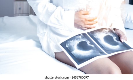 Uterus, Ovaries, Ovarian Cysts And Abnormalities In Cells, Close To Each Other, Woman Sitting  Closed To Her Stomach Because Of Abdominal Pain And A X-ray Film.