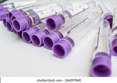 Vacutainer,test Tube