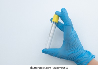 Vacuum Tube For Collection And Blood Samples With Sodium Citrate In Blue Gloves For Laboratory. On White Background