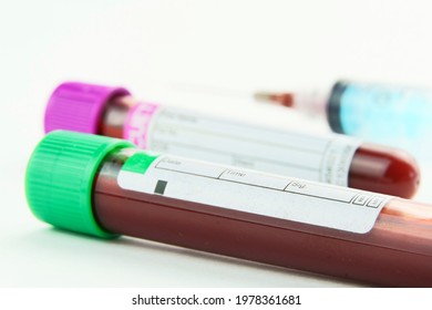 193 Purple vacutainer Images, Stock Photos & Vectors | Shutterstock