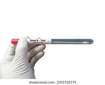 Vaginal swab for Strep B testing in microbiologist hand on white background.