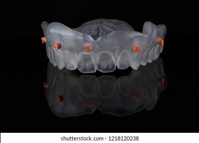 Vaksap - Digital Impression Of The Upper Jaw 3d Printing, Shot On Black Mirror With Otradeniem