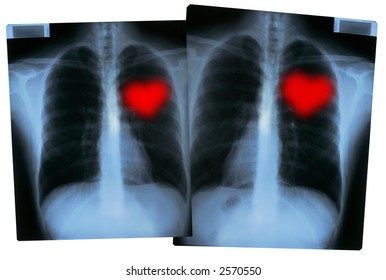 104 Love Valentines Xrays Hearts Images, Stock Photos & Vectors 