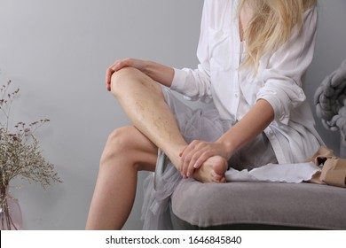 Varicose vein laser surgery recovery and prevention, Compression Stockings Thigh