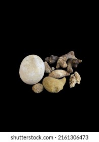 Various Types Of Stones In The Human Body Including Bladder Stones, Kidney, Pancreatic, And Gall Bladder Stones Are Isolated.