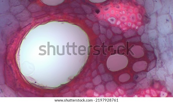 A vascular bundle is a part of the transport\
system in vascular plants.