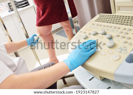 a vascular surgeon or phlebologist makes an ultrasound of varicose veins on the legs of a female patient. Phlebology, thrombosis, vascular asterisks.