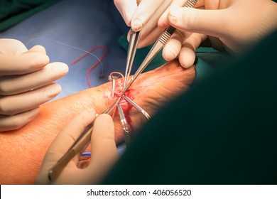 Vascular Surgery