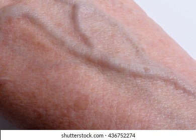 Veins On The Wrist Of An Older Woman