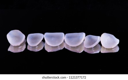 Veneers  Crowns Prosthetics