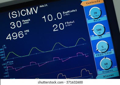 Ventilator Screen