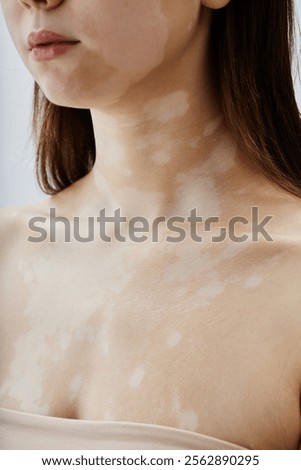 Vertical close up on neck and collarbone of young woman with vitiligo embracing natural beauty of white skin patches in unique pattern while posing in studio, copy space
