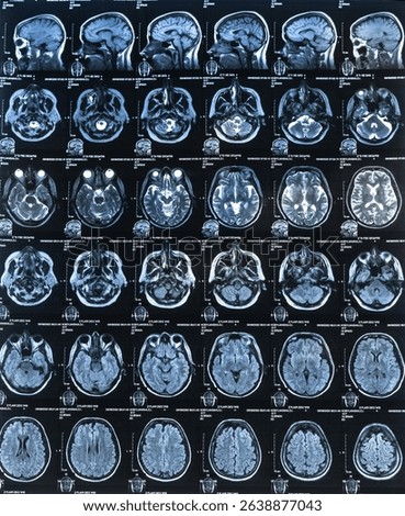 Vertical CT scan image of human brain. Mri or x-ray scan for diagnostic human head diseases.