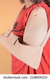 Vertical, medium close-up image of a man with his left arm in a sling and a scar on his shoulder after an operation to place a screw for a broken humerus.