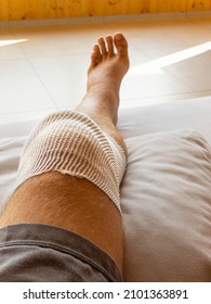 VERTICAL, POV: Looking Down At Your Knee Wrapped In White Bandages After A Meniscus Surgery. Male Patient In Home Care After Knee Drainage Surgery Rests His Leg On His Leather Couch. Post-surgery Rest