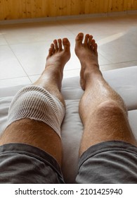 VERTICAL, POV: Male Patient In Home Care After Knee Drainage Surgery Rests His Leg On His Leather Couch. Looking Down At Your Knee Wrapped In White Bandages After A Meniscus Surgery. Post-surgery Rest