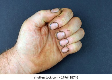 Dirty Fingernails Images Stock Photos Vectors Shutterstock